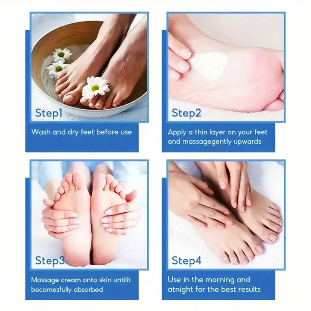 Urea Cream 45 2 Salicylic Acid Callus Remover Foot Moisturizer Hand