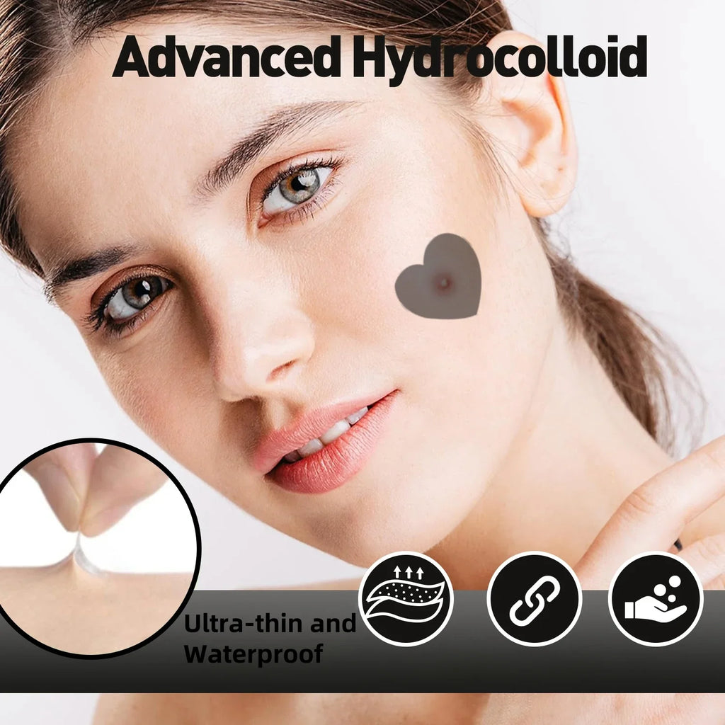 Hydrocolloid Acne Patches – Invisible, Waterproof | All Skin Types