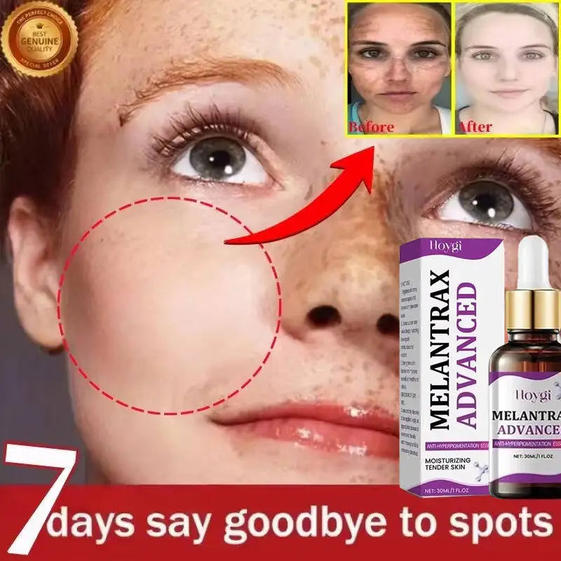 Hoygi Niacinamide Vitamin B3 Face Serum – Glow & Dark Spot Corrector
