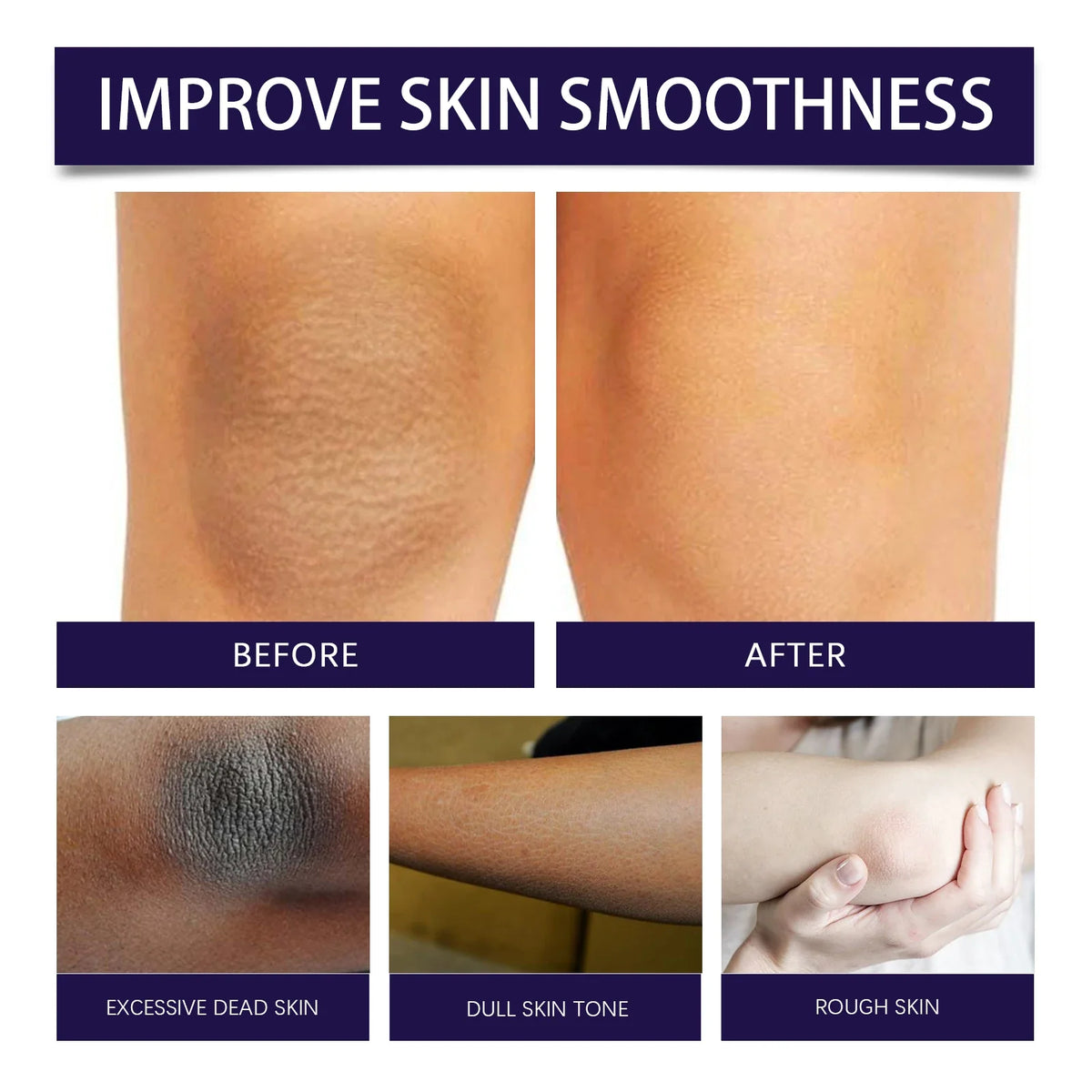 Eelhoe Body Scrub – Exfoliate, Brighten & Moisturize Skin