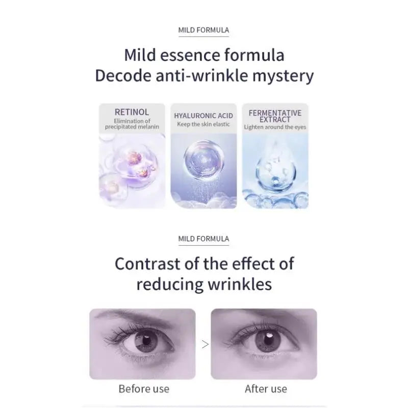 OCHEAL Hyaluronic Acid Roller Eye Cream – Dark Circles & Fine Lines