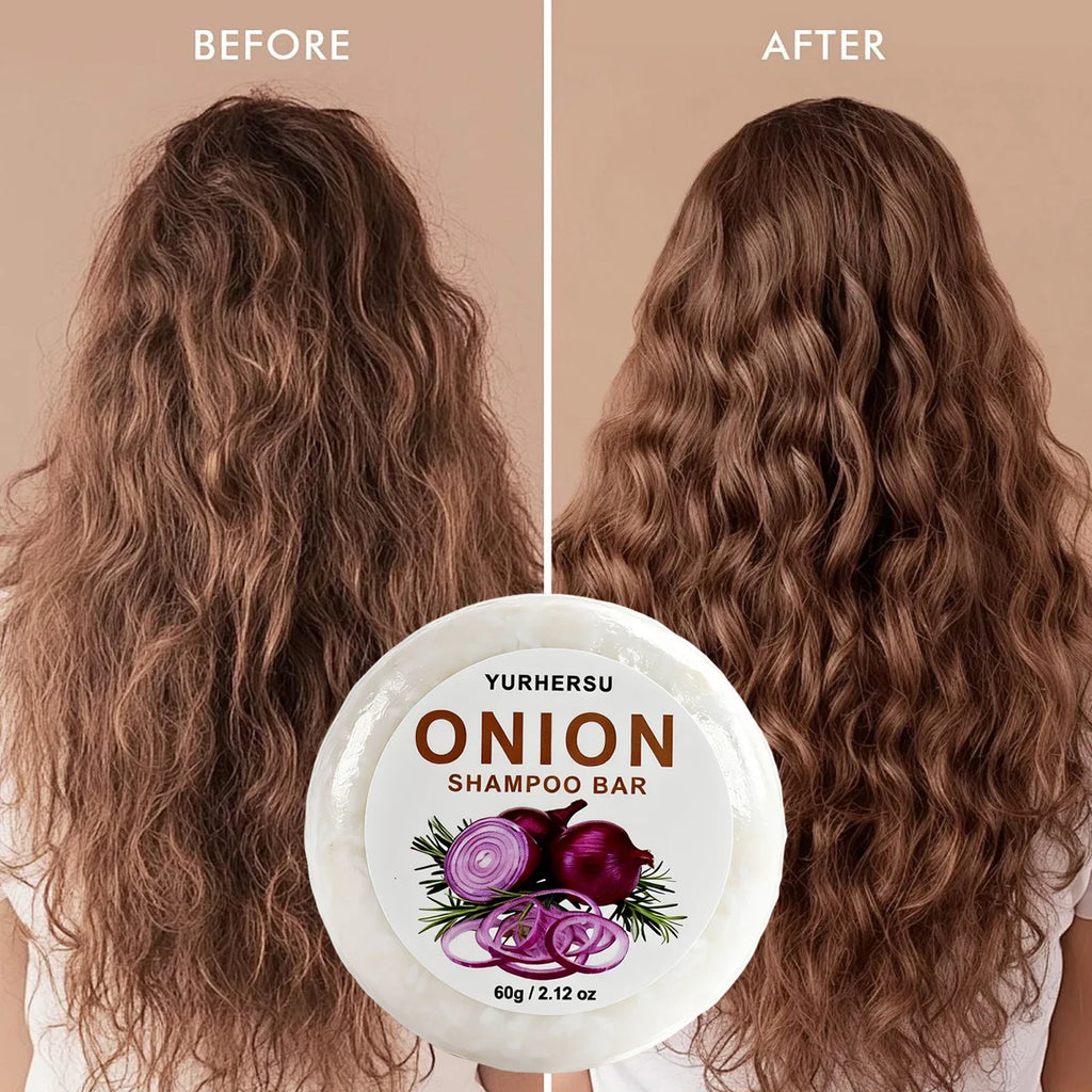 Vegan Onion Shampoo Bar – Oil Control, Frizz & Scalp Care