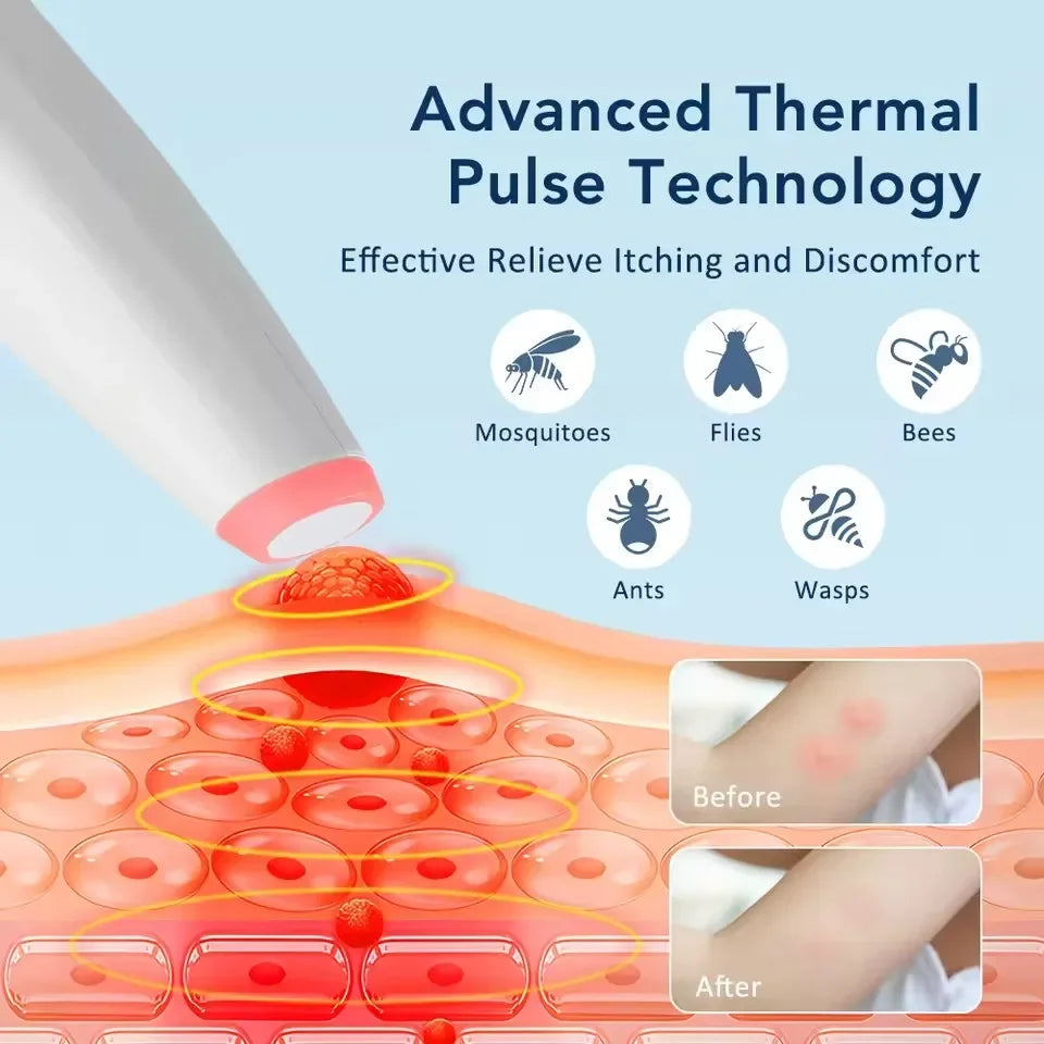 Infrared Pulse Itch Relief Pen | Insect Bite Soother
