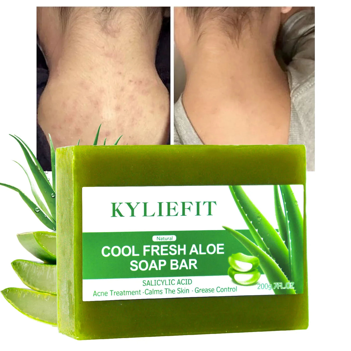 AILKE Aloe Brightening Soap Bar | Dark Spot & Oil Control 200g