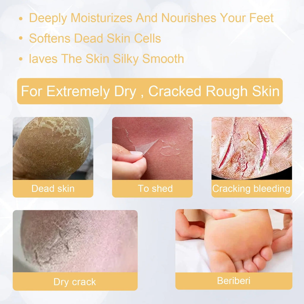 Foot Exfoliating Spray 200ml – Dead Skin & Callus Remover