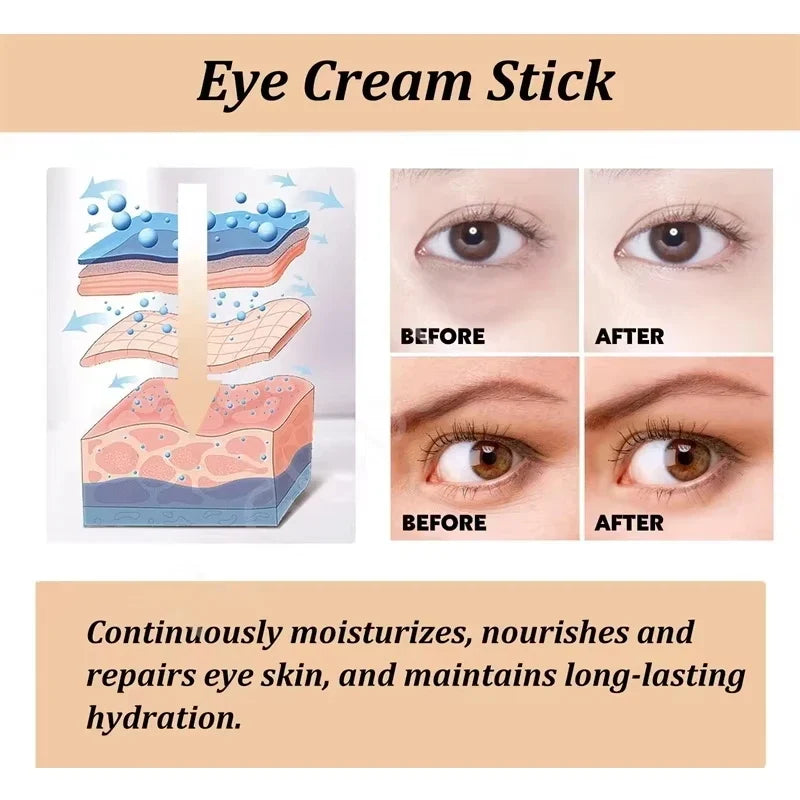 SADOER Retinol Rolling Bead Eye Serum – Firm & Brighten