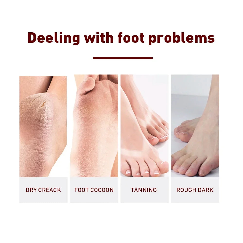 Exfoliating Foot Peel Mask Socks – Dead Skin Remover