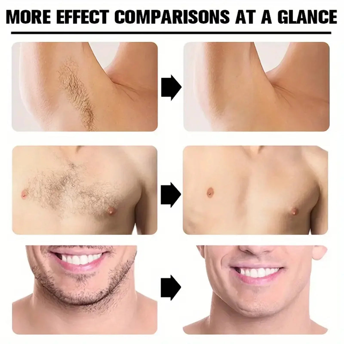 Hair Removal Cream for Women & Men – Full Body 150g