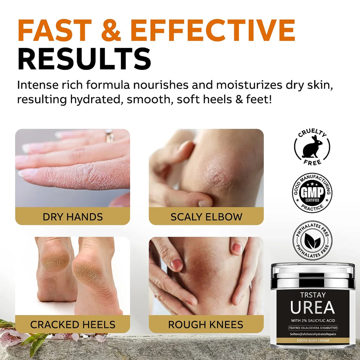 Urea Cream 40 Percent Feet Foot Dry Cracked Heels Knees Elbows Repair