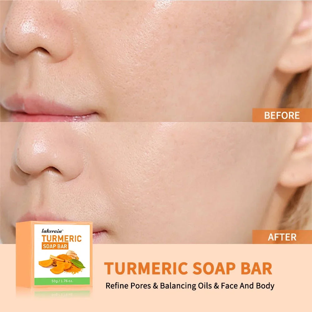 Handmade Turmeric Soap Bar – Face & Body Brightening Cleanser