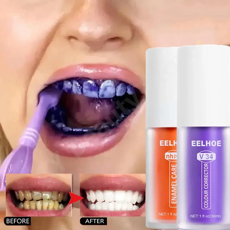 V34 Whitening Toothpaste 2-Pack | Stain Removal & Fresh Breath