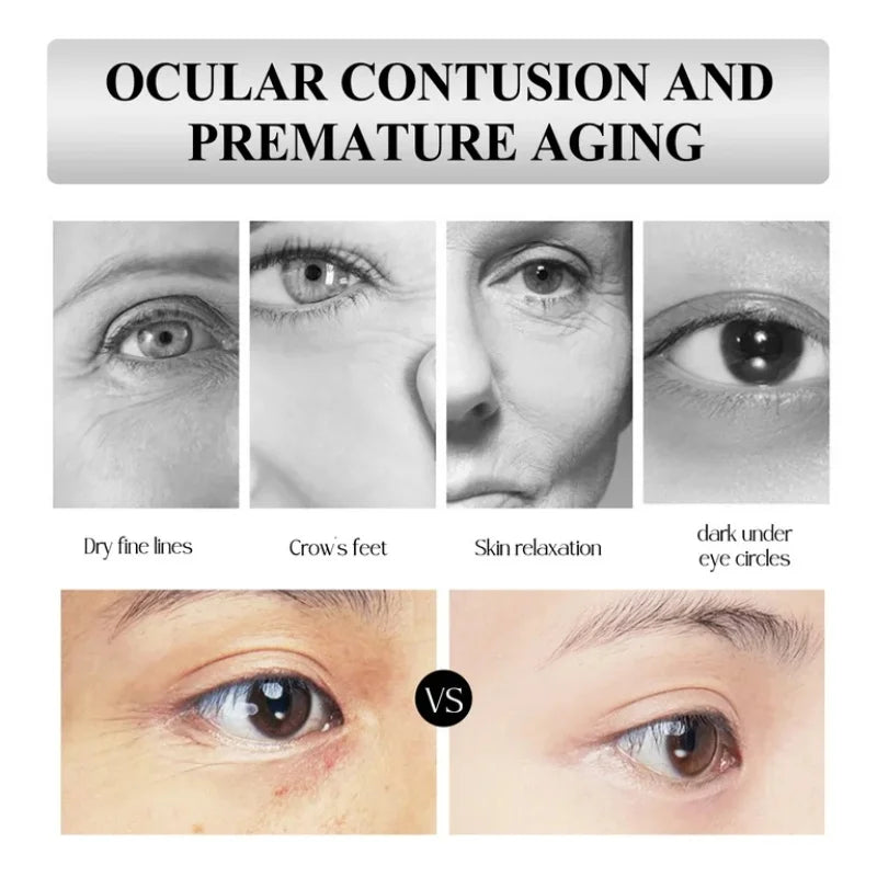 Retinol Eye Cream – Firming, Dark Circle & Hydrating 15ml