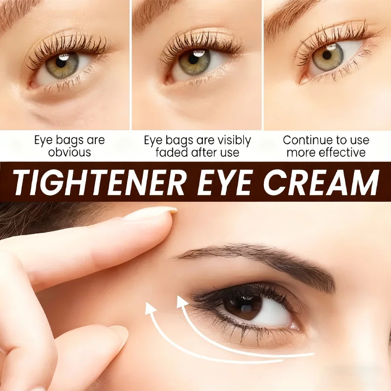 Botax Eye Cream 24H Lifting – Vitamin C, Retinol & Bee Venom