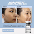 Sanendi Hyaluronic Acid PDRN Glutathione Retinol Serum 5×7ml