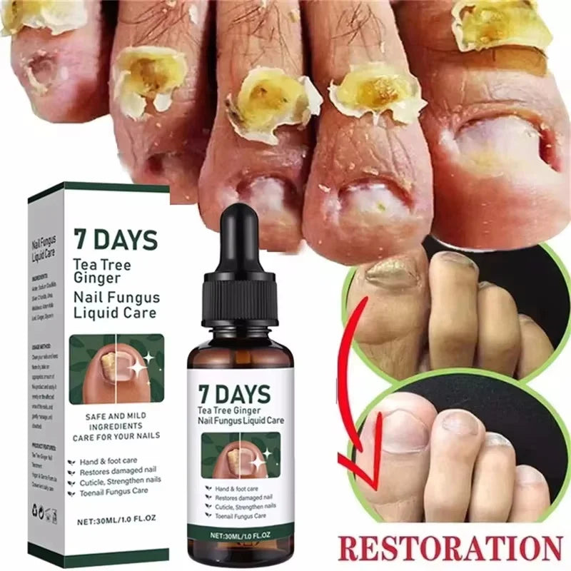 Ginger Nail Repair Serum – Restore Discolored & Uneven Nails