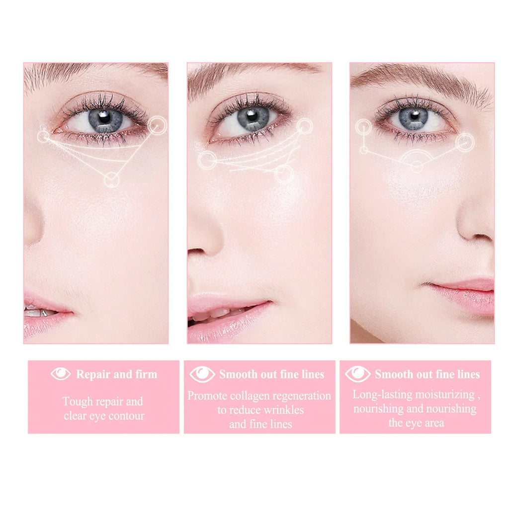 EELHOE Mango Eye Cream – Firming, Dark Circle & Fine Line Reducer