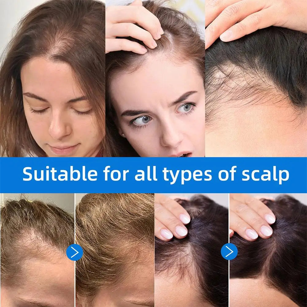 Scalp Hair Essence Rollerball Serum – Anti-Frizz & Strengthening
