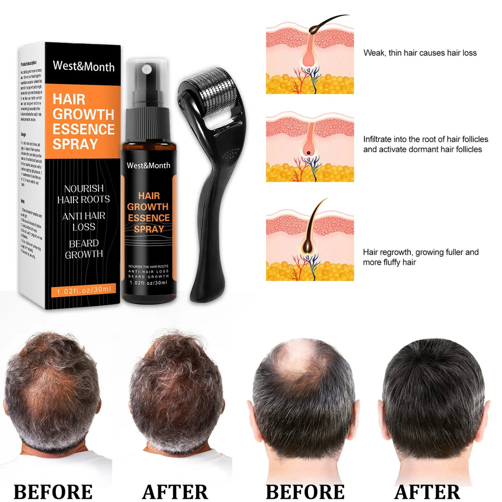 Hair Thickening Scalp Spray – Polygonum & Ginger Nourishment