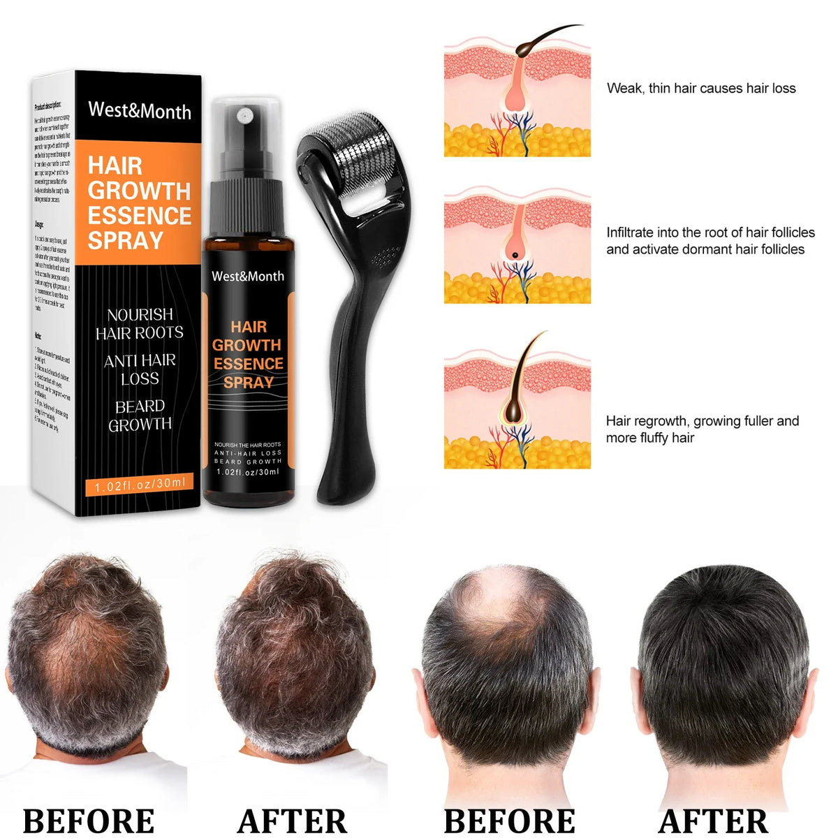 Hair Thickening Scalp Spray – Polygonum & Ginger Nourishment