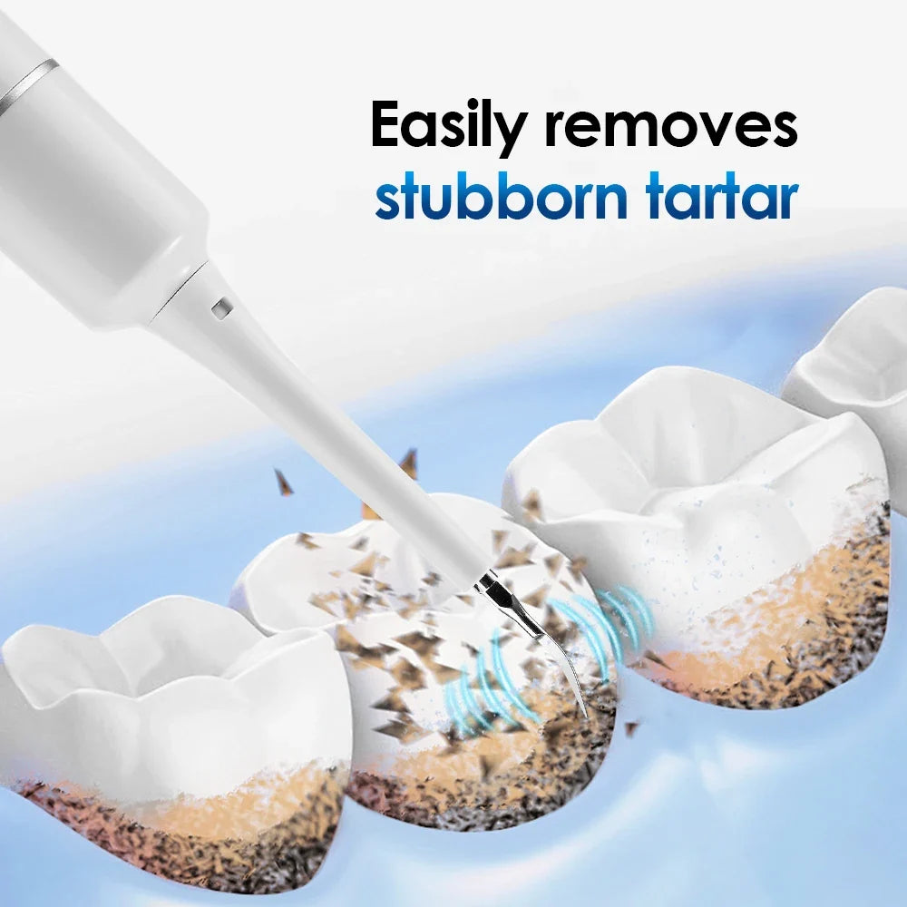 Ms.Dear Electric Tartar Remover & Whitening Toothbrush – 6 Modes