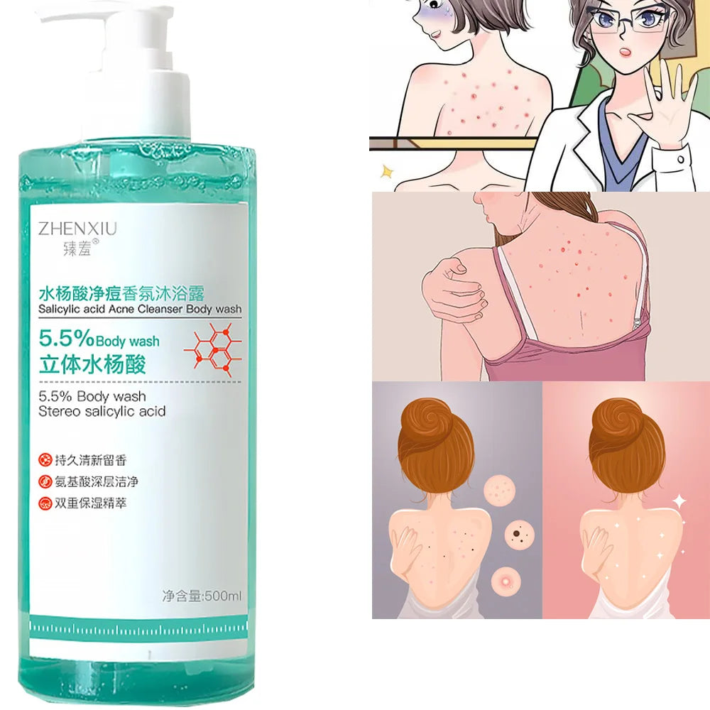 Salicylic Acid Body Wash Gentle Smoothing Mild Exfoliating Daily Acne
