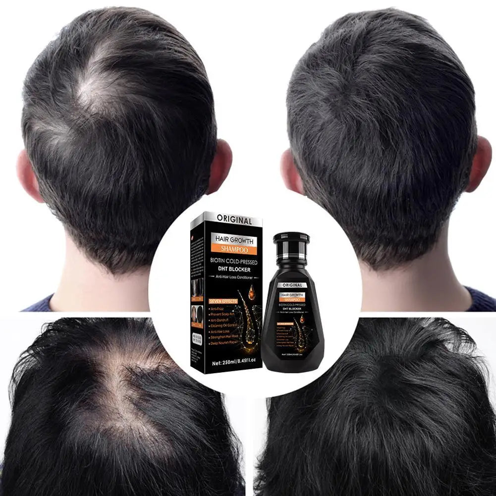 Biotin & Ginger Shampoo for Hair Growth & Thinning 250ml