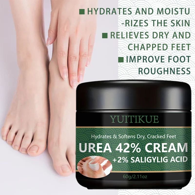YUITIKUE 42% Urea Foot Cream – Softens Calluses & Hydrates