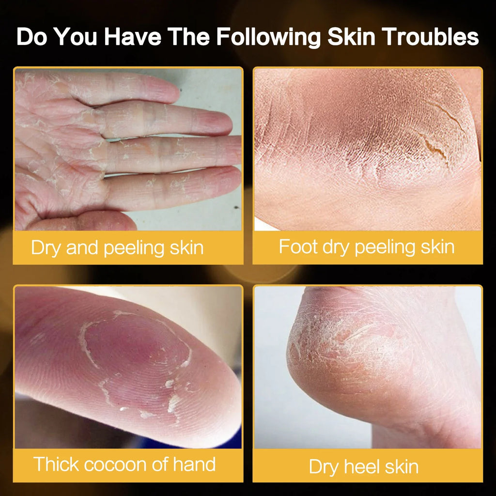 Intensive Hydrating Foot & Hand Balm – Nourishing Heel Cream