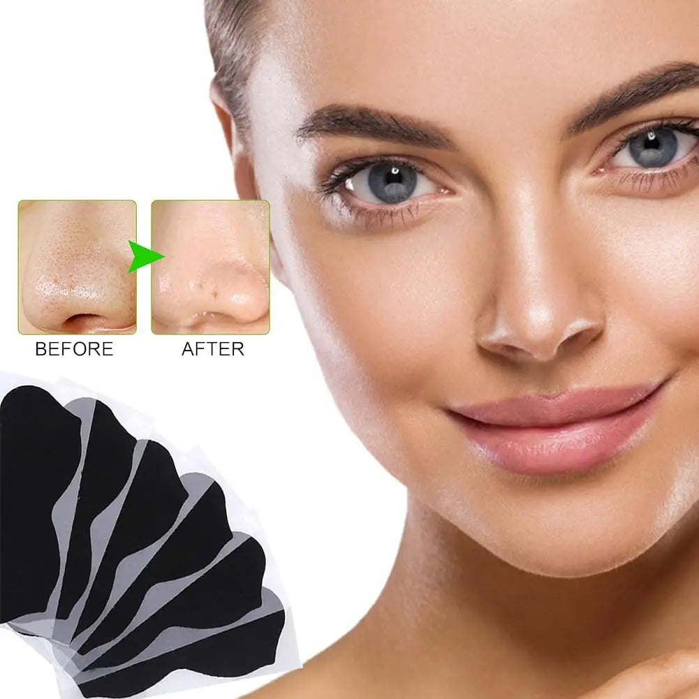 Blackhead Remover Nose Strips – Charcoal & Witch Hazel