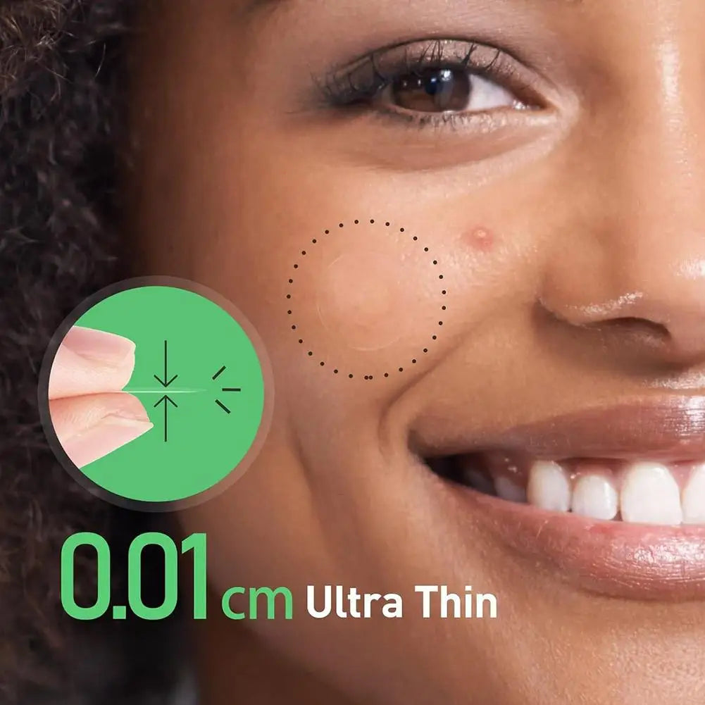 24-Pack Microneedle Acne Patches – Invisible & Waterproof