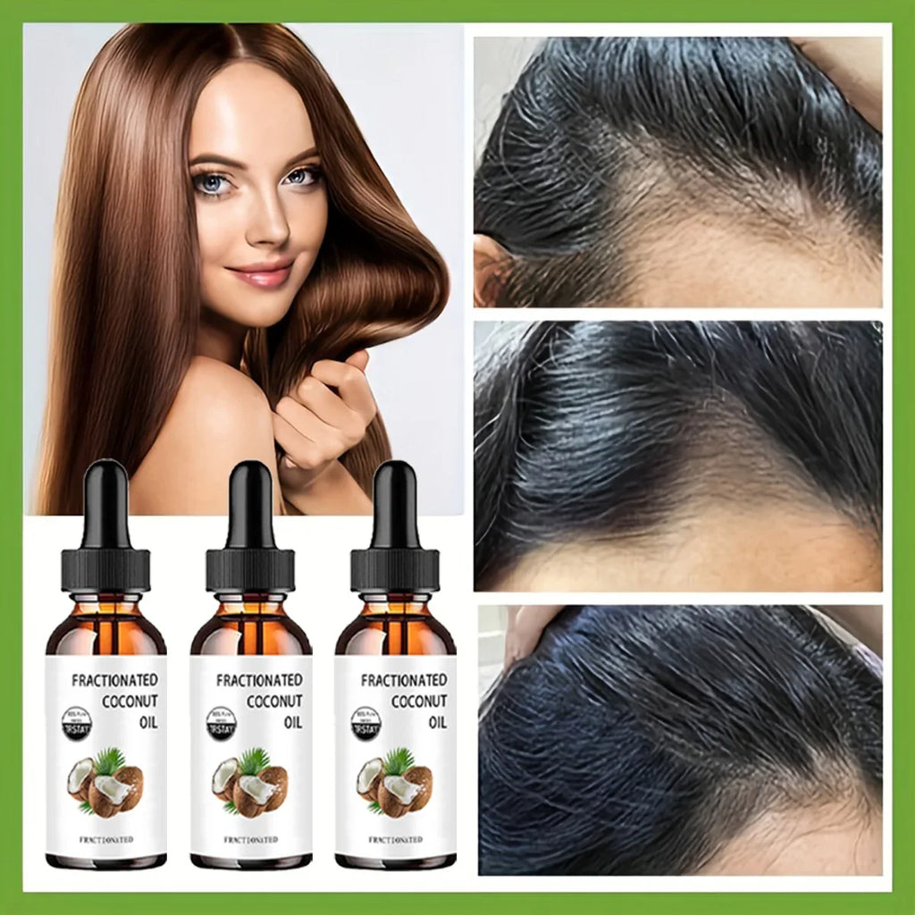 TRSTAY 100% Pure Fractionated Coconut Oil – Skin & Hair Care