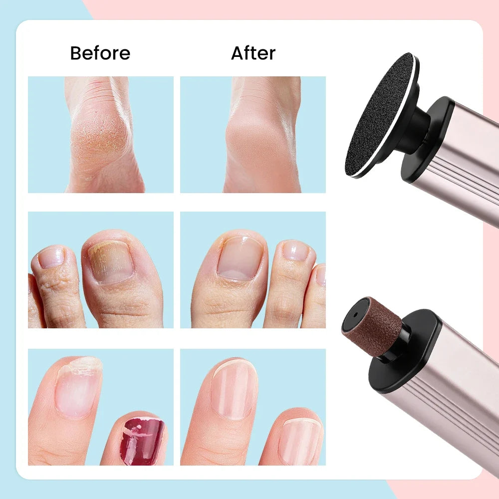 Electric Foot File Pedicure Machine – 9-Speed Rechargeable