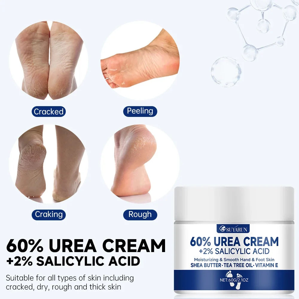 SUYARUN 60% Urea Foot Cream – Callus Remover & Heel Moisturizer