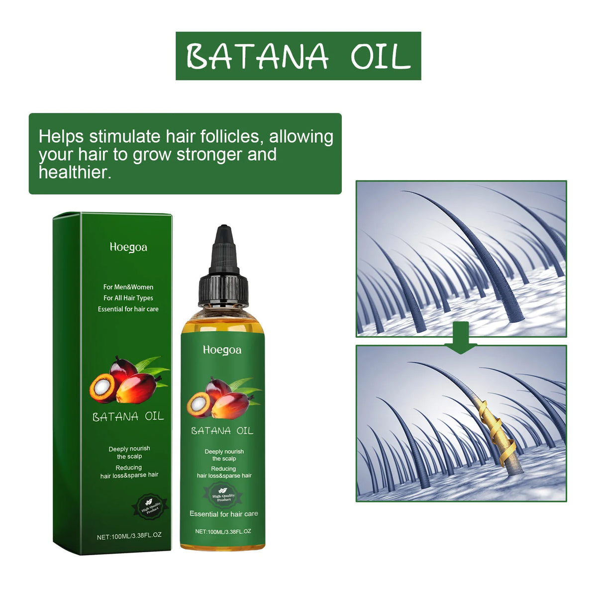 HOEGOA Hair Growth Oil – Scalp Nourishing & Frizz Control