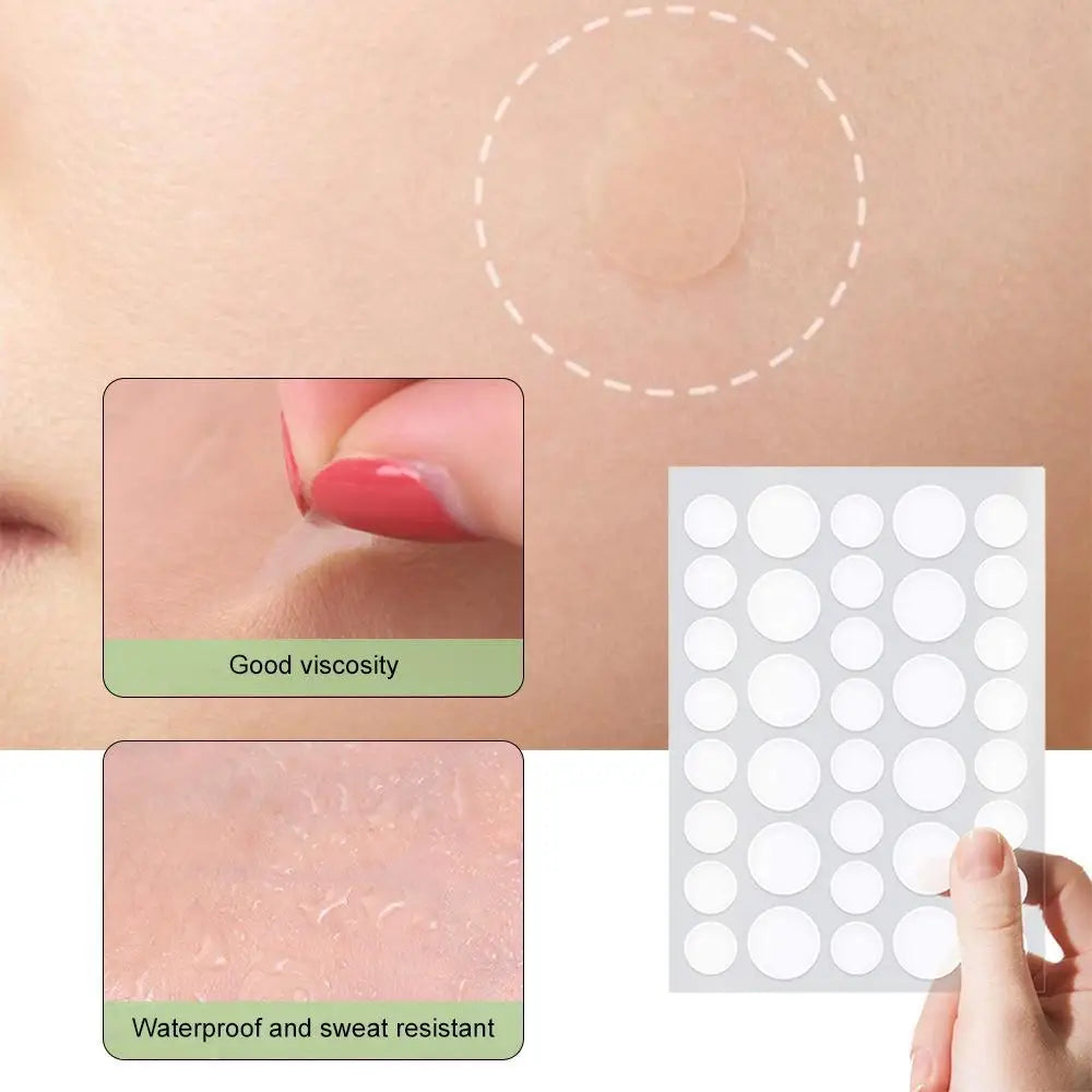 Ultra-Thin Invisible Pimple Patches – 72 or 288 Count