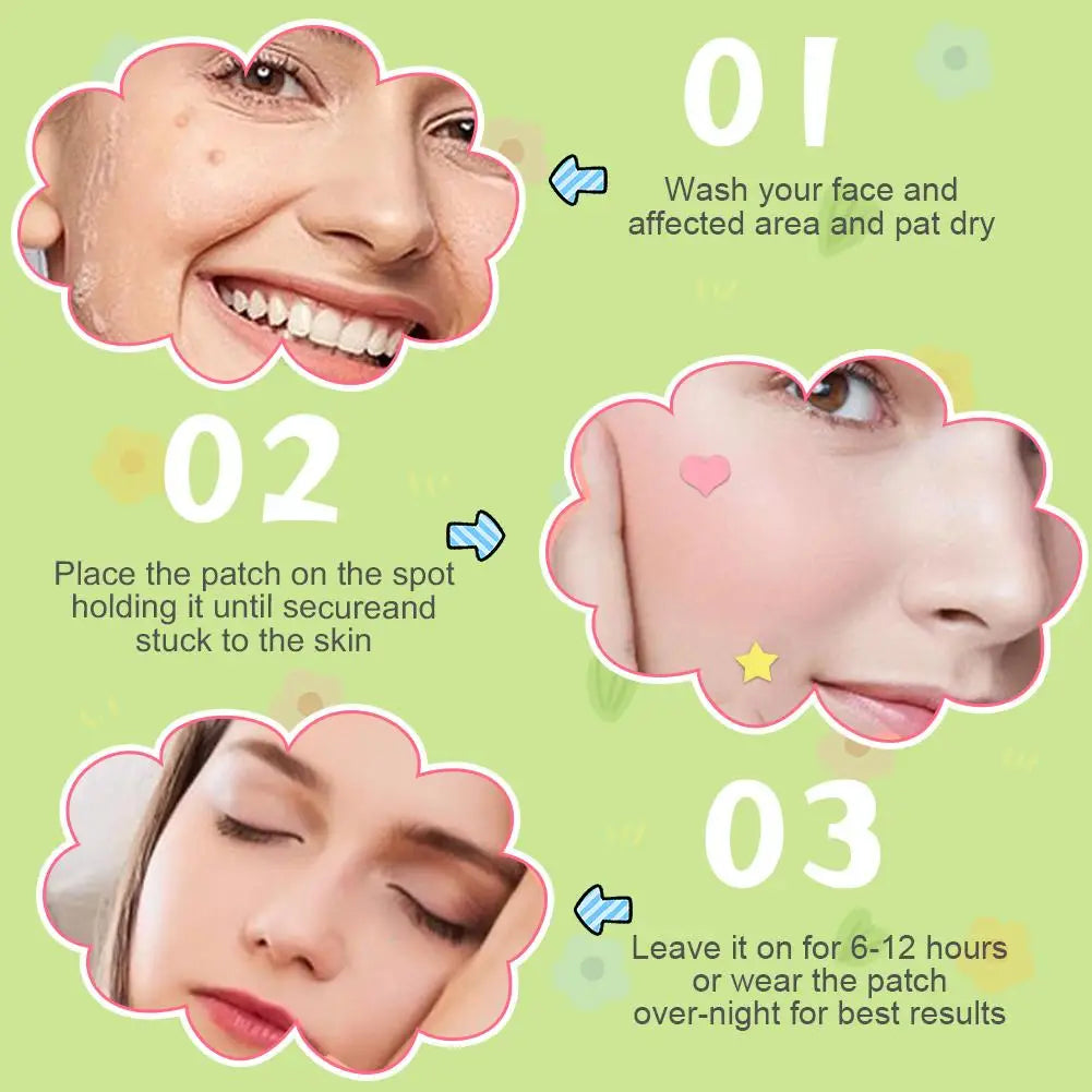 216-Count Colorful Invisible Pimple Patches | Acne Cover Stickers