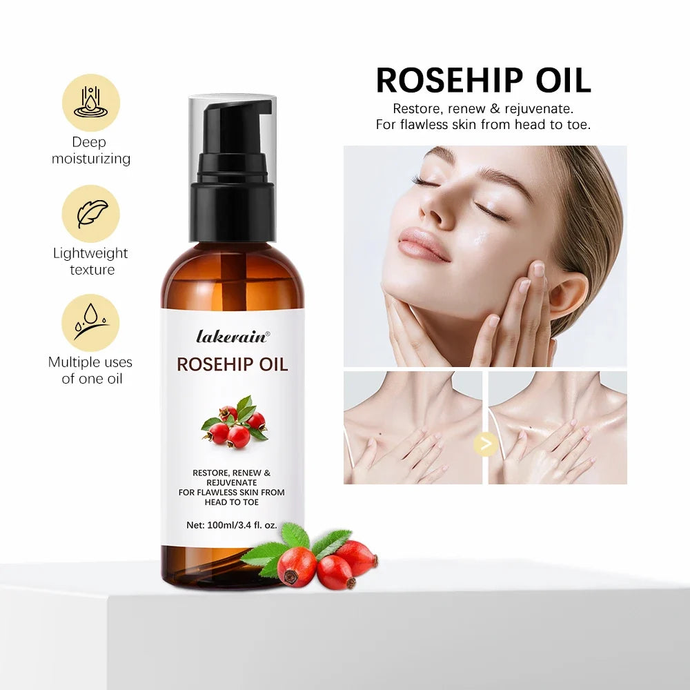 Organic Rosehip Oil 30ml – Face, Body & Hair Moisturizer