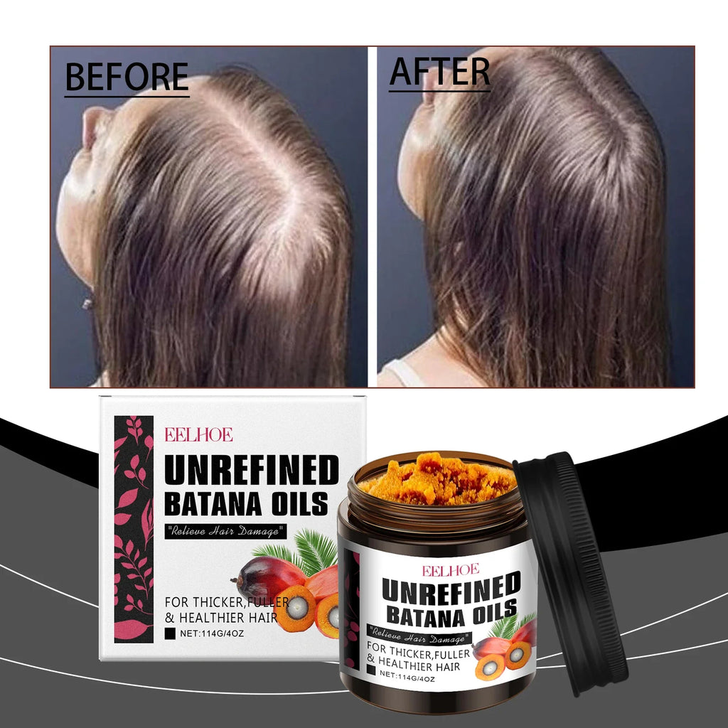 Eelhoe Batana Hair Conditioner & Growth Spray Kit | Dry Hair Repair