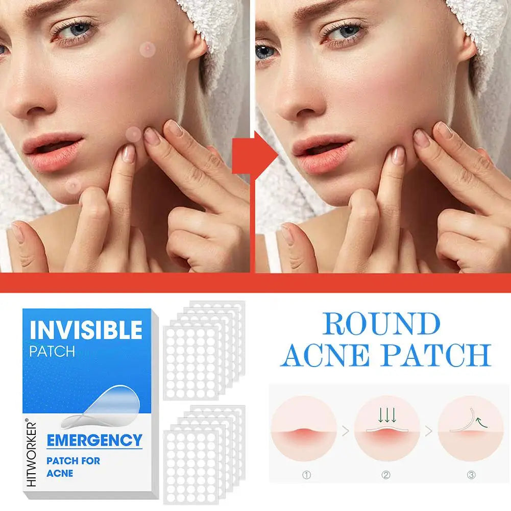 Hydrocolloid Acne Patches – Salicylic Acid & Tea Tree 400-1200pc