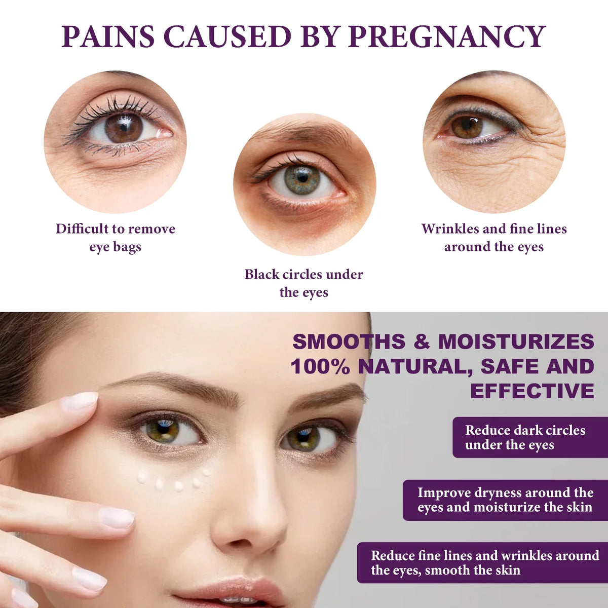 Hoygi Eye Cream – Dark Circles, Bags & Wrinkles 30ml