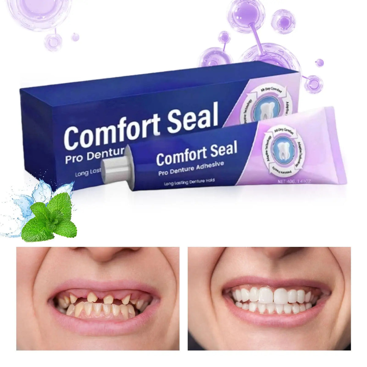40g Denture Adhesive Cream – Strong Hold All-Day Secure Fit