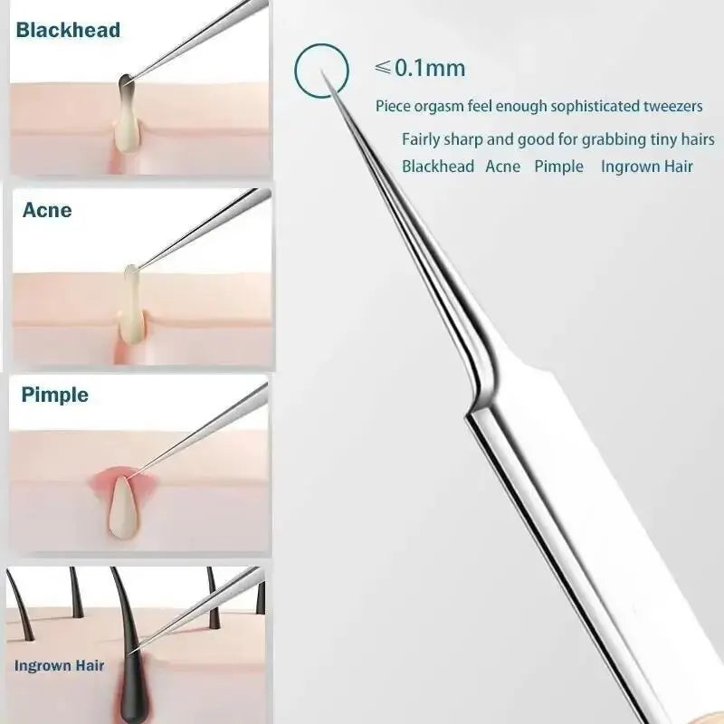 11-Piece Blackhead & Ingrown Hair Removal Skin Care Tool Set