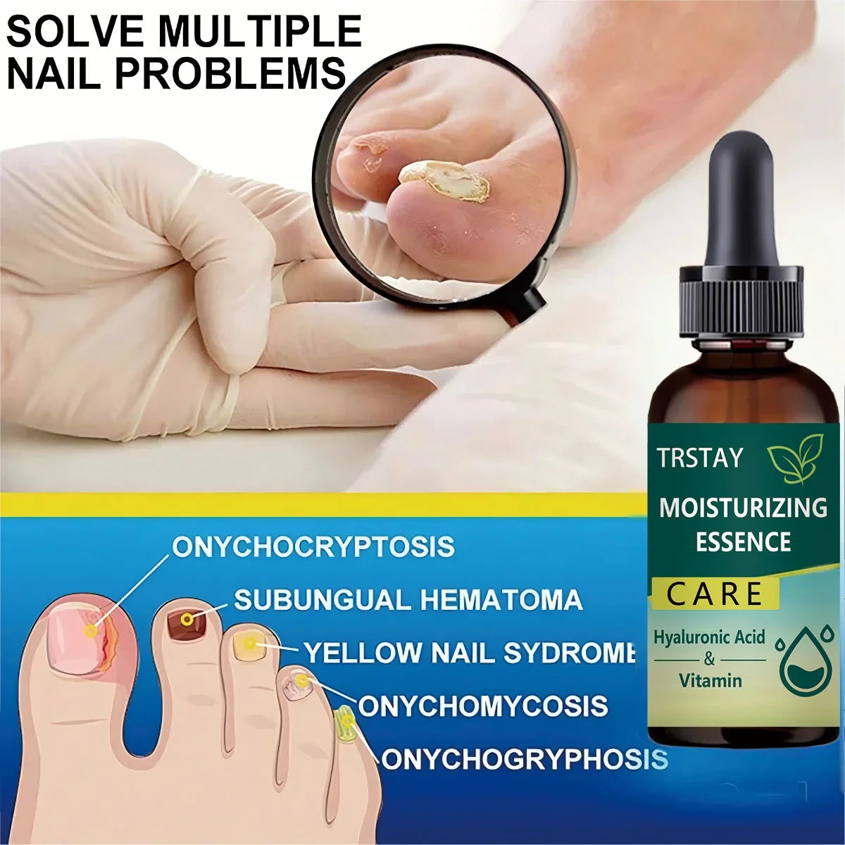 7DAYS Nail Repair Essence Gel – Toe & Foot Care Serum