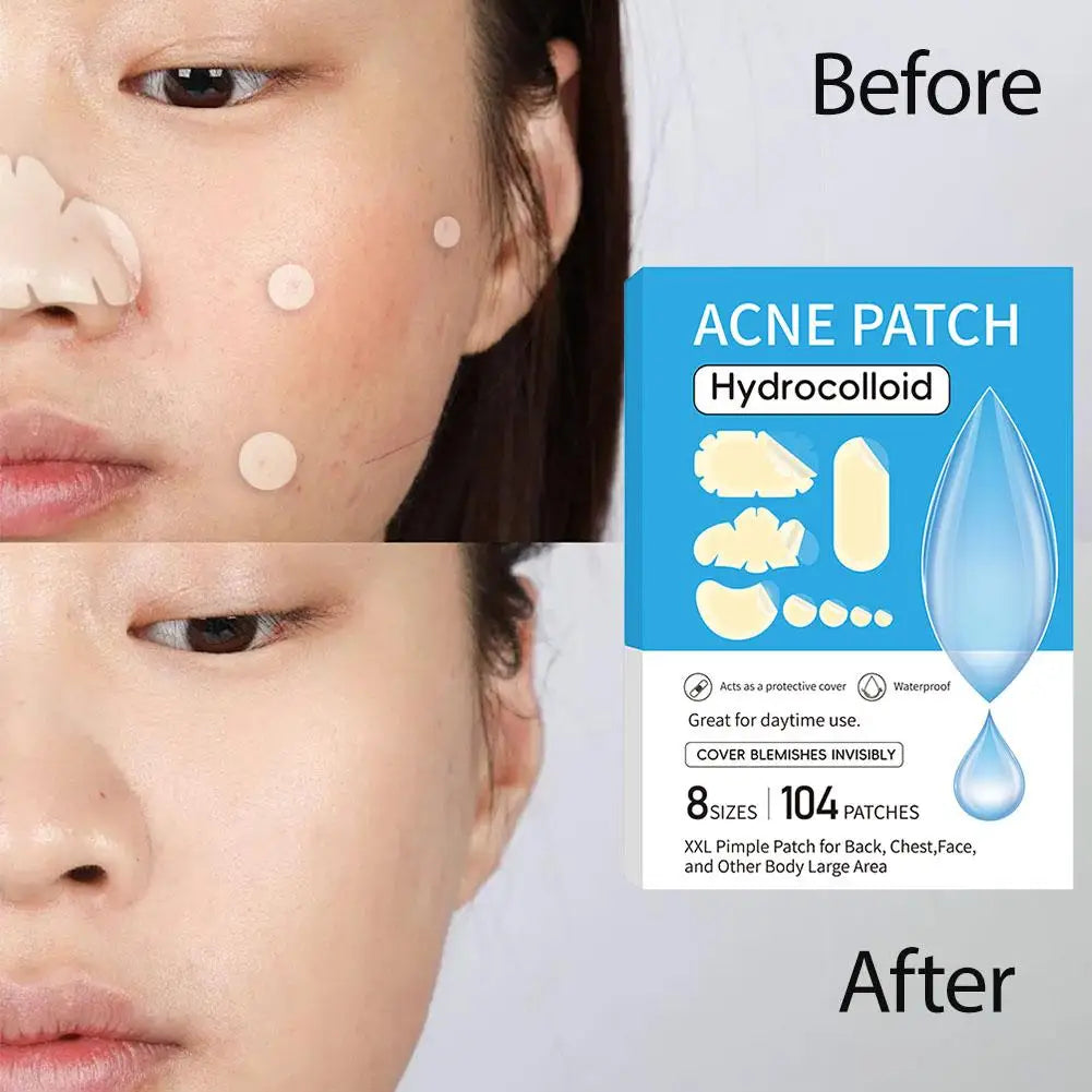 Large Hydrocolloid Pimple Patches Bulk – 9 Styles Face & Body