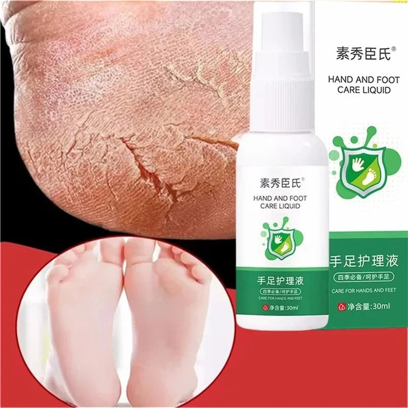 LAIKOU Herbal Foot Cream Spray – Soften & Moisturize Heels