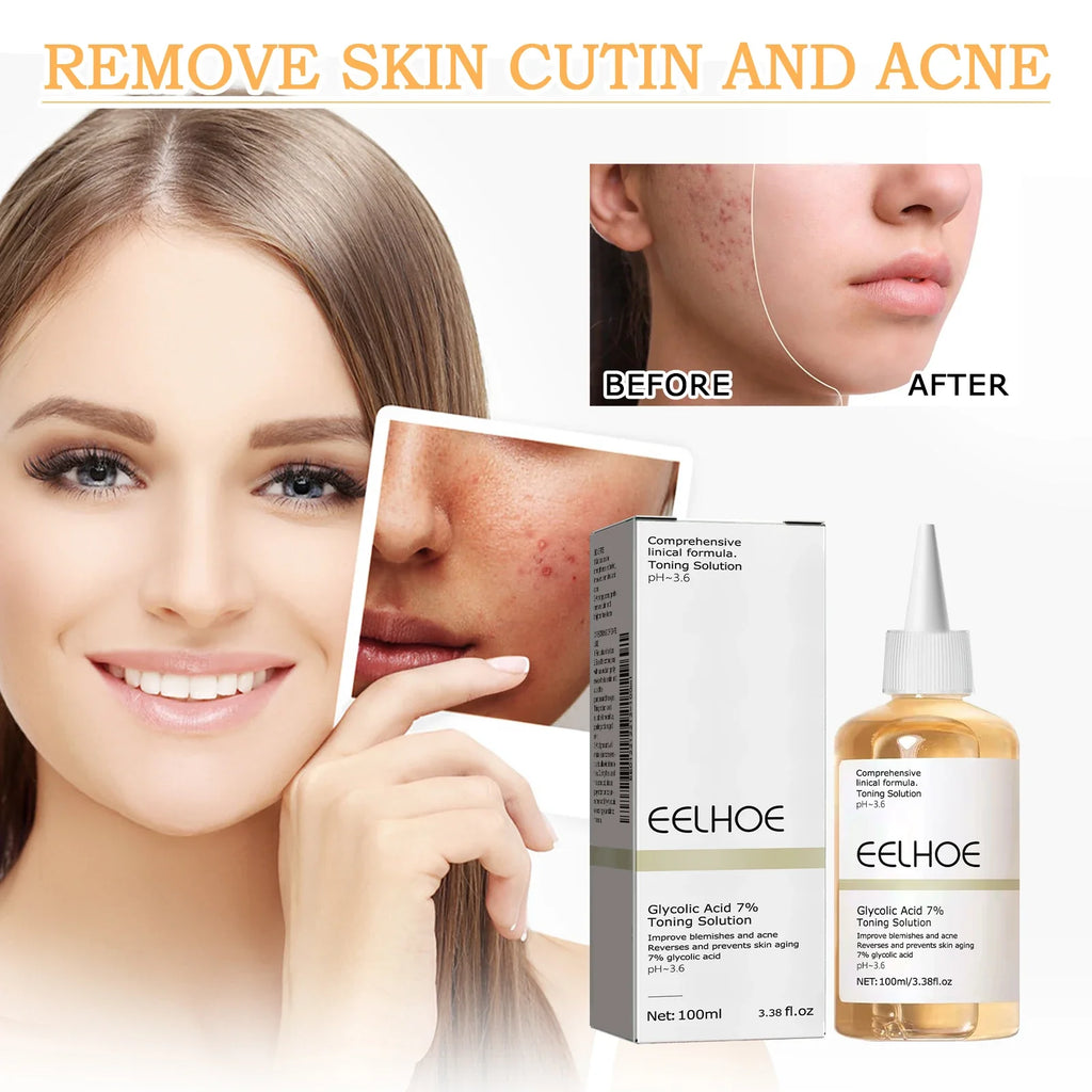 7% Glycolic Acid Toner – Brighten, Exfoliate & Hydrate Skin
