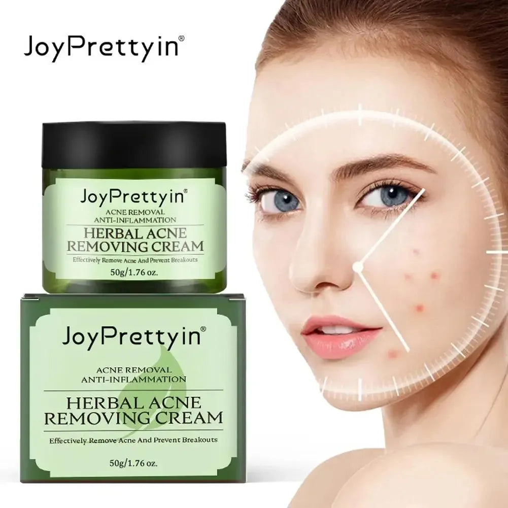 JoyPretty Herbal Acne Face Cream – Oil Control & Marks Removal