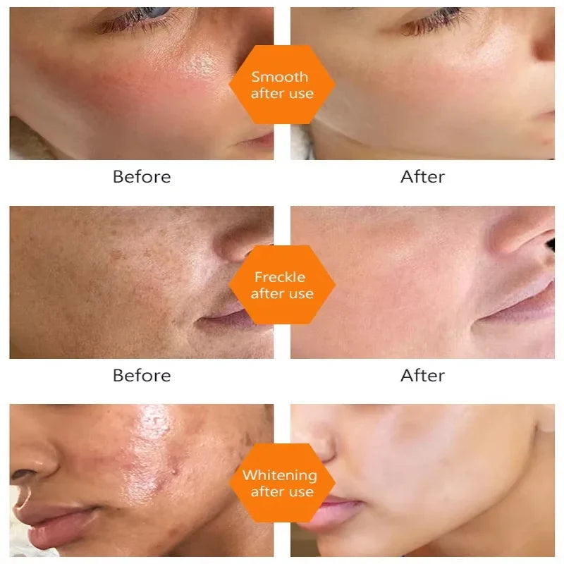 Turmeric Oil Dark Spot Brightening Facial Serum | eelhoe