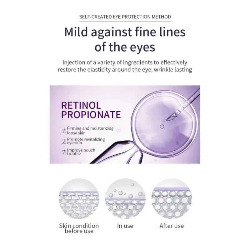 OCHEAL Hyaluronic Acid Roller Eye Cream – Dark Circles & Fine Lines
