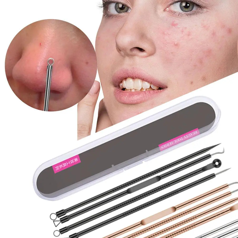 4-Piece Blackhead Remover Tool Set – Stainless Steel Acne Kit